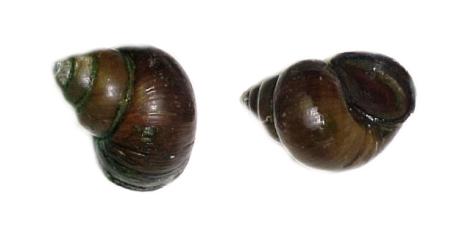 广东男童感染寄生虫病,男童寄生虫病