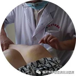 临沂市中医院医保门诊报销政策,不用医保也能报销的医院