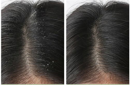 生姜防脱育发洗发水推荐,老姜王生姜防脱育发洗发水300ml