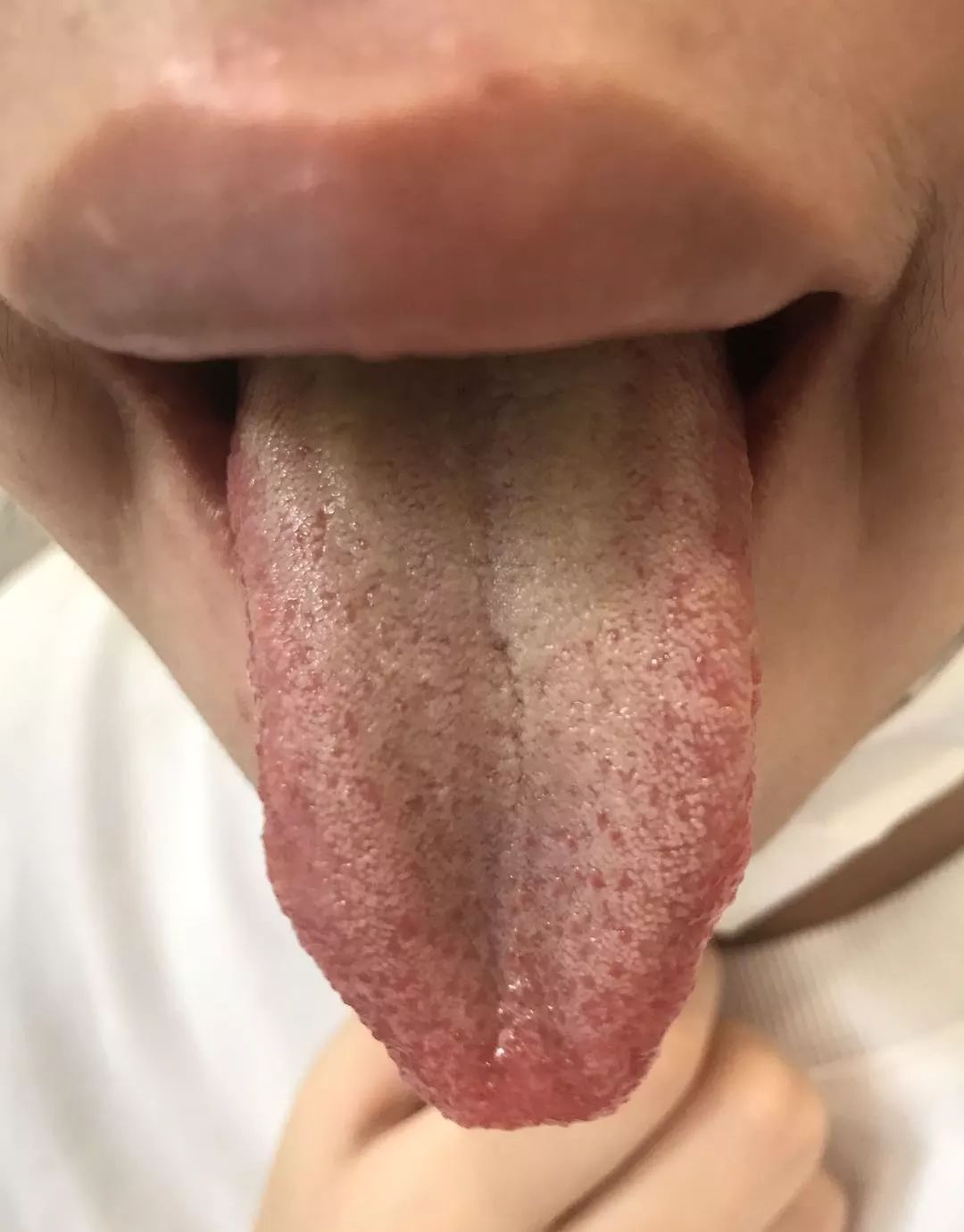 红豆薏米祛湿气真有效吗,红豆薏米去湿气推荐