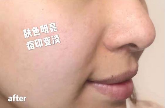 喝胶原蛋白要坚持多久才能有效果,紧急提醒经常喝这个的人要注意了