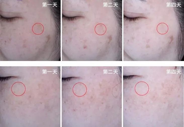 长期补充胶原蛋白的人怎么样了,长期喝胶原蛋白的人最后怎么样了