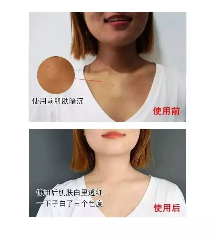 长期补充胶原蛋白的人怎么样了,长期喝胶原蛋白的人最后怎么样了