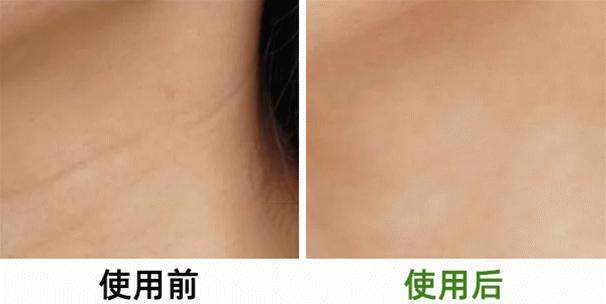 喝胶原蛋白要坚持多久才能有效果,紧急提醒经常喝这个的人要注意了