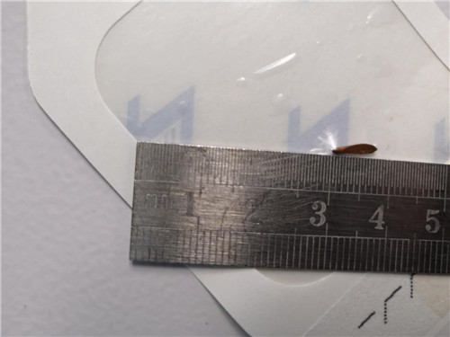 想说“取”你不容易！8mm铜丝贯穿眼球，安医四附院医生借助骨科利器保住男子视力