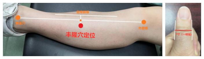 治疗青春痘中医古方也能迅速奏效,奇效火针治疗青春痘