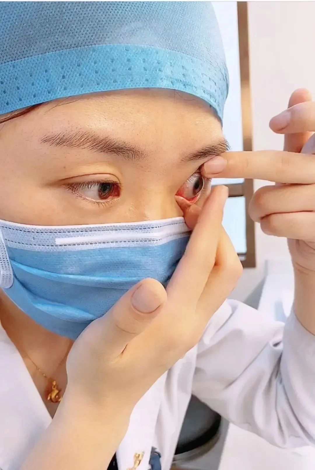 隐形眼镜可以徒手摘吗,摘隐形眼镜有什么好方法吗