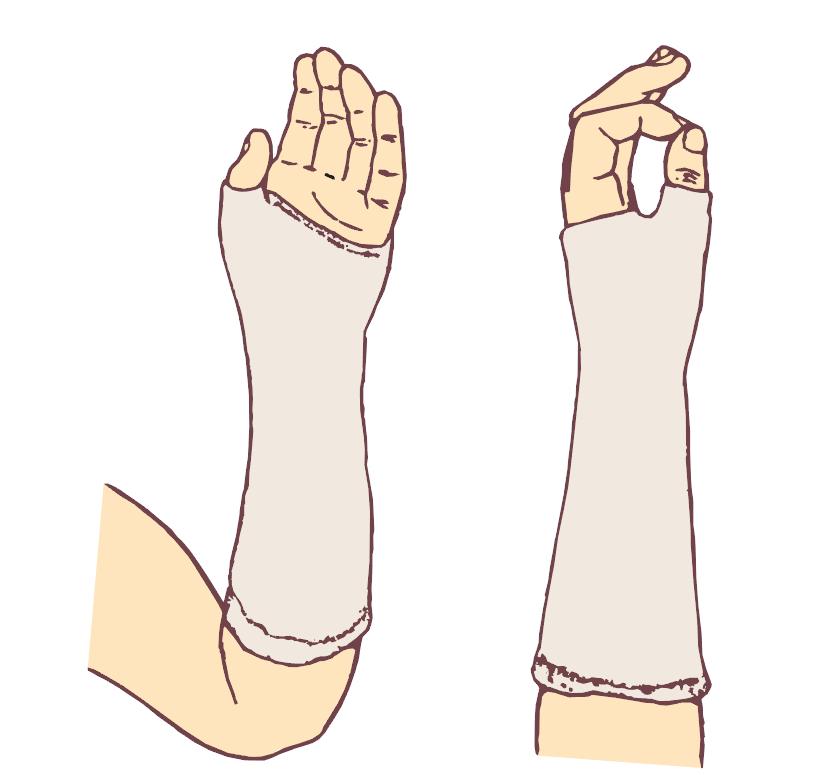 腕部损伤与康复,腕部损伤正确处理方法