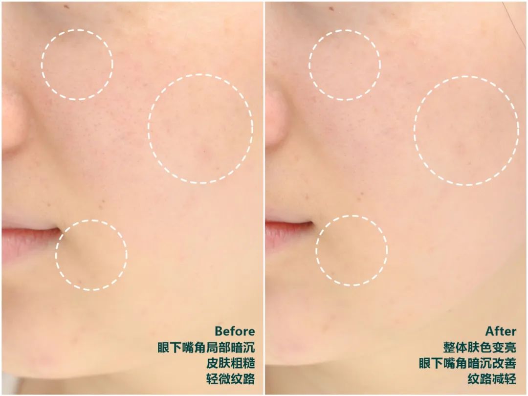 推广｜|啊啊啊，这些经常回购的东西终于打折了