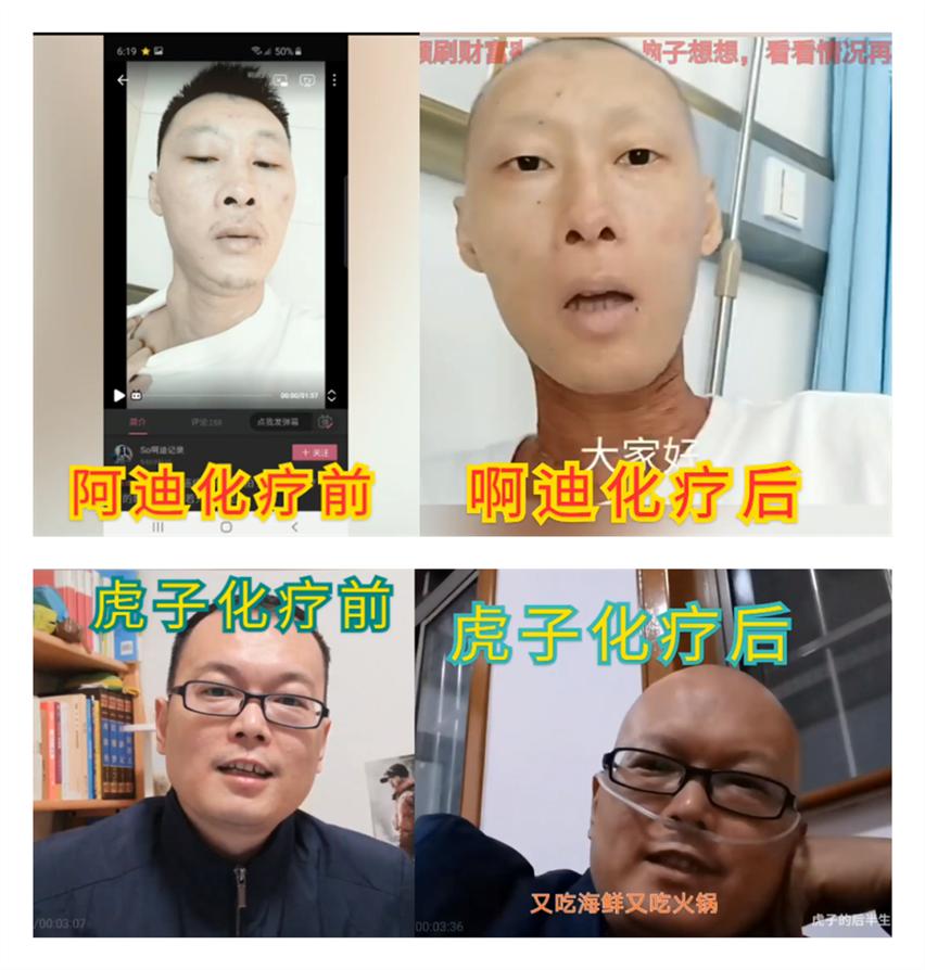 b站回应患癌博主被质疑造假,b站肺癌博主被质疑造假