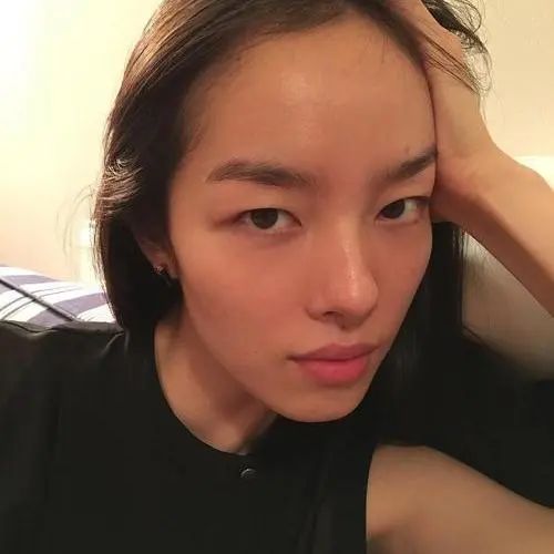 变双眼皮半个月后回到单眼皮,双眼皮怎么临时变成单眼皮