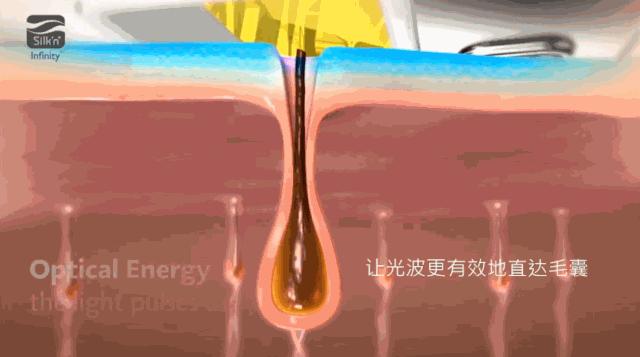 超良心真人测评！花了28天，告诉你脱毛仪到底值不值得买|辣妈研究所065