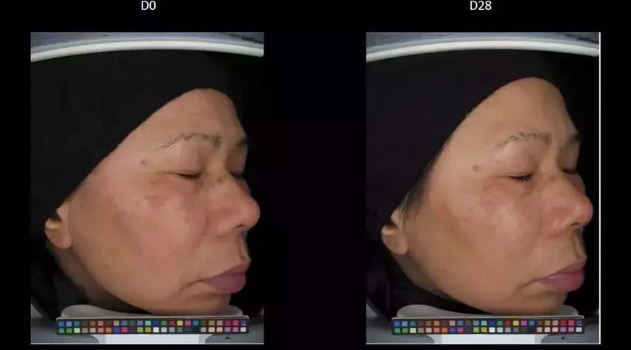 女生变白的正确方式,女生想要变白到底有多简单