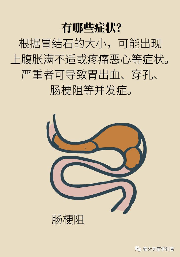 胆结石肝上也有结石怎么办,胆结石胆管里面有结石怎么办