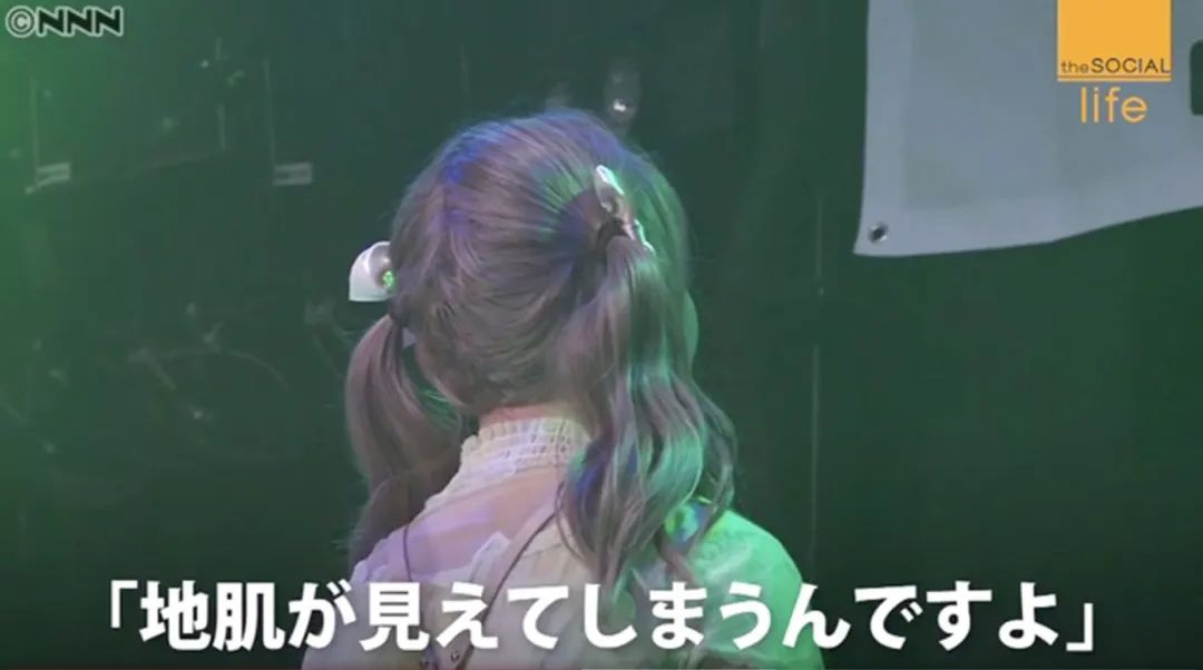 日本16岁美少女偶像歌手脱发到光头！“沦为”假发模特后的她，没有忘记自己甜美的笑容...