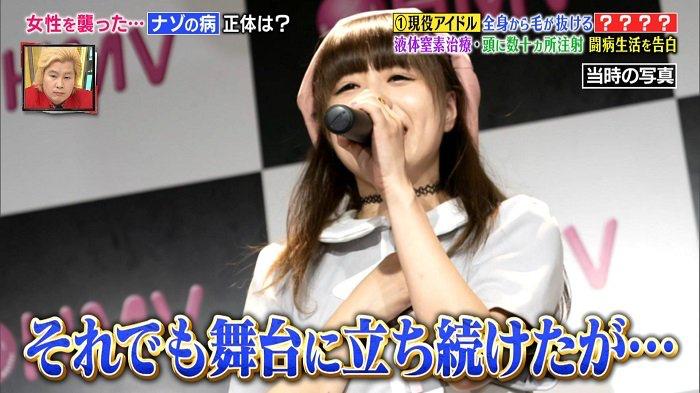 日本16岁美少女偶像歌手脱发到光头！“沦为”假发模特后的她，没有忘记自己甜美的笑容...