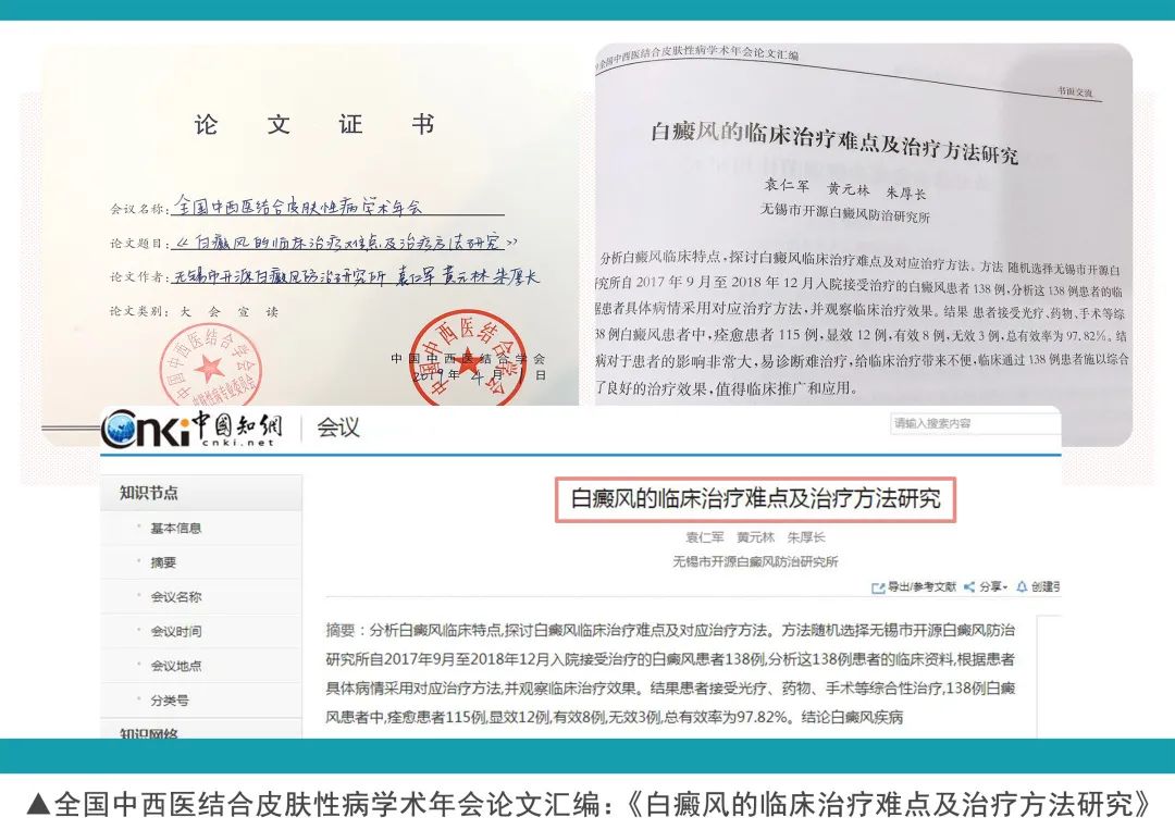 全国征集10名白癜风病友免费治疗,白癜风公益招募500名患者