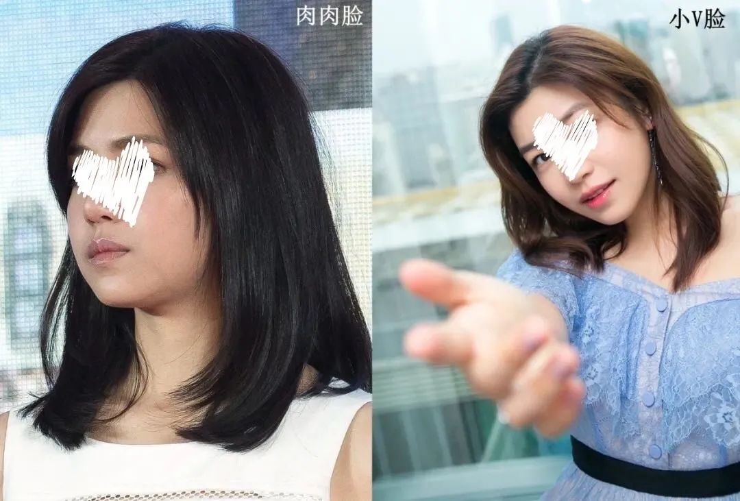 双下巴用提拉面膜有用吗,双下巴提拉紧致面膜怎么用