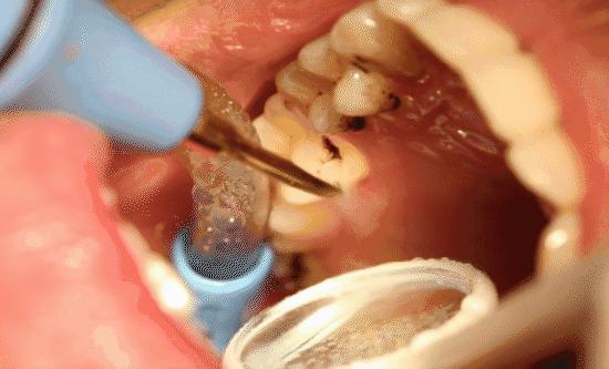 omg年龄大吗,omg年轻的秘诀