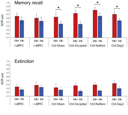 强迫症经颅磁刺激治疗,强迫症大脑最新研究