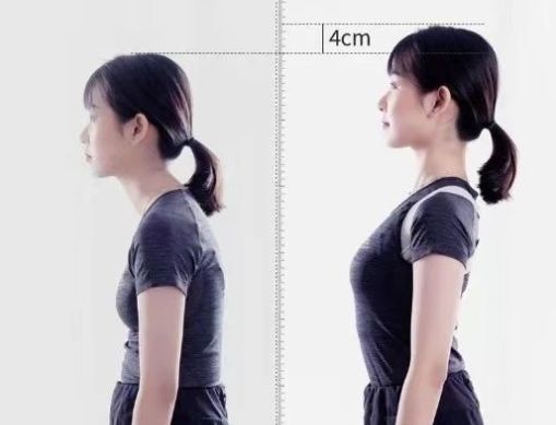 有什么方法可以改善含胸驼背,含胸驼背改善的方法