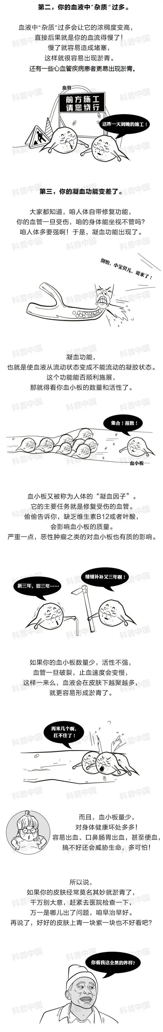 身上莫名其妙有淤青是怎么回事,身上莫名其妙有淤青的灵异说法