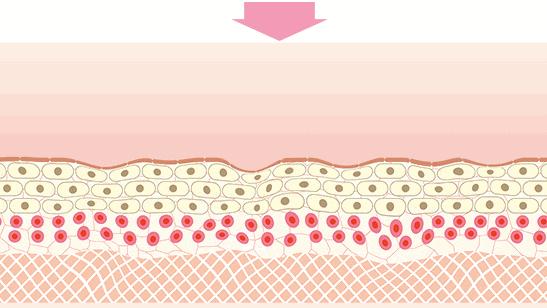 女人脖子有颈纹和年龄有关吗,一条颈纹代表二十岁