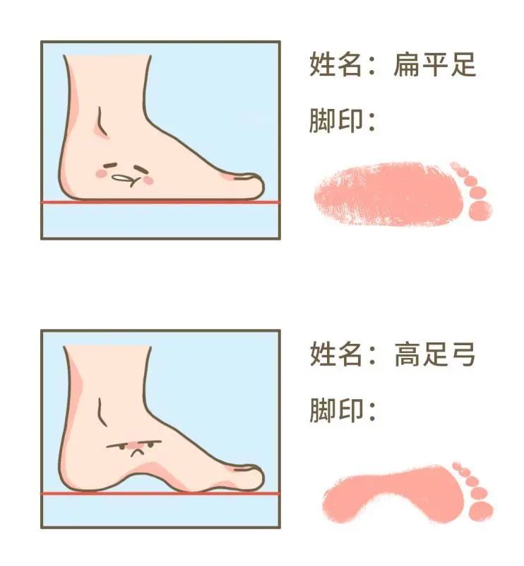 总嚷嚷走不动的人，可能是脚没长对