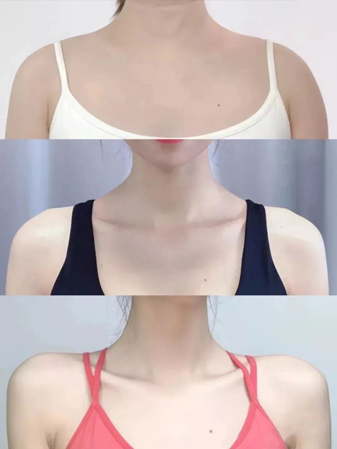 驼背平时自己注意可以改善吗,驼背如何矫正自己的气质