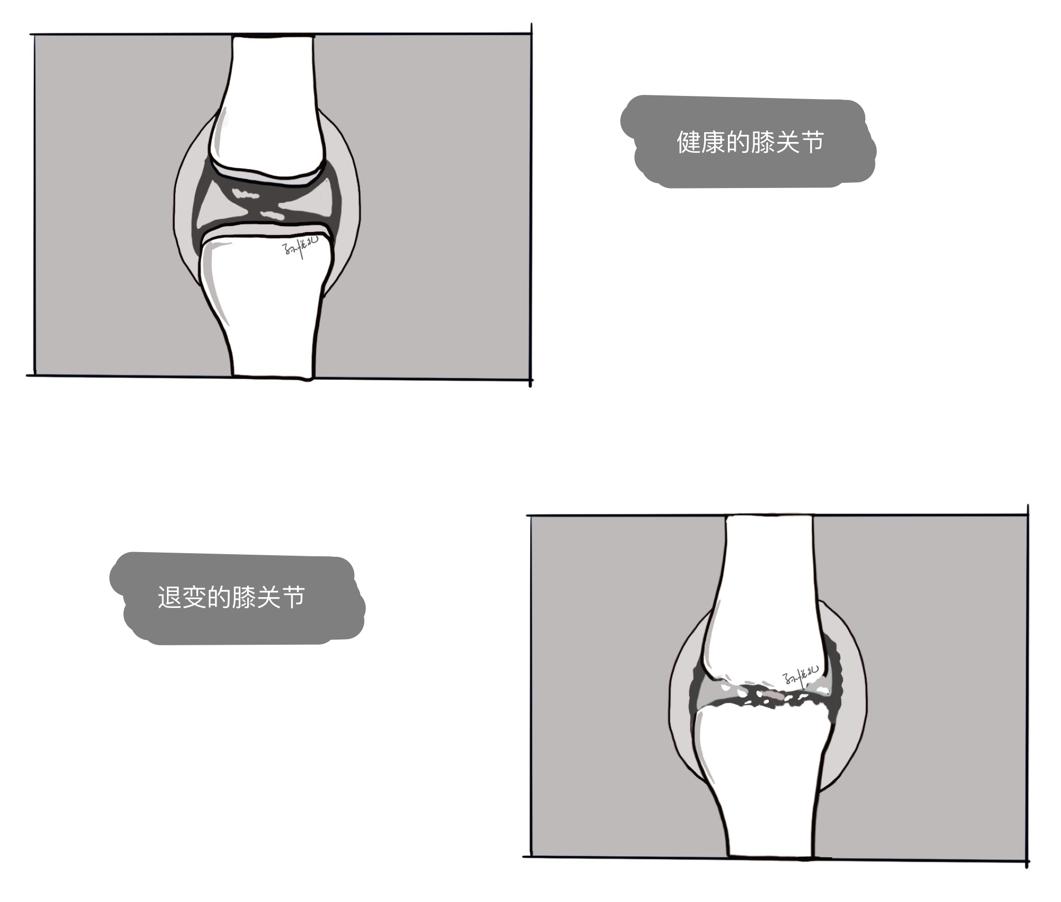 膝关节发凉吃什么药,肩膀发凉怎么保暖