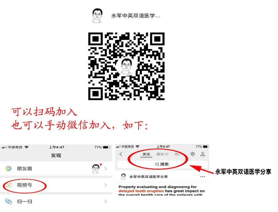 中心静脉导管血栓形成,中心静脉导管是什么
