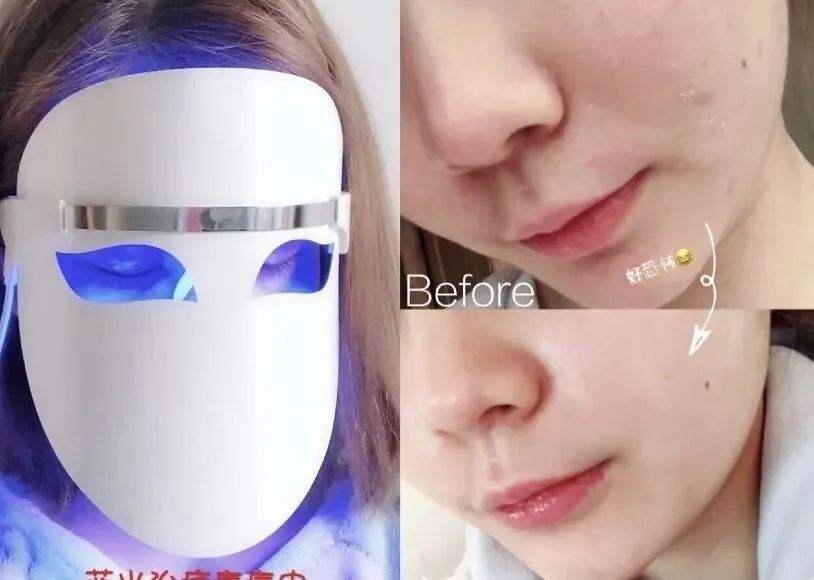这个黑科技口碑人气王，只要10分钟让你有面膜的使用感