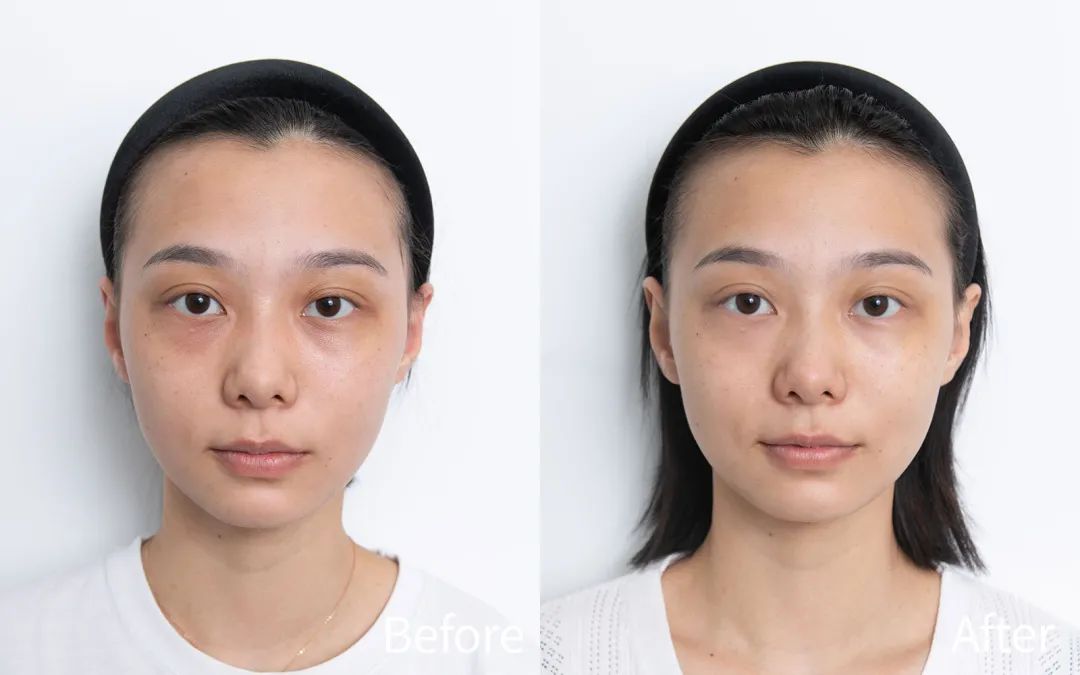 用空瓶回购眼霜,值得空瓶回购的眼霜