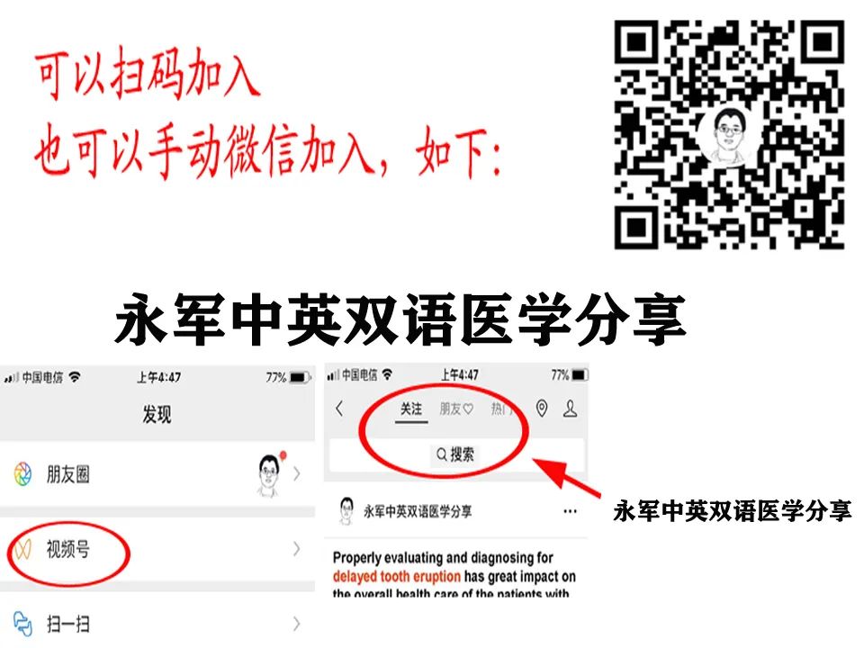 b群链球菌感染小孩几率,b族链球菌感染原因