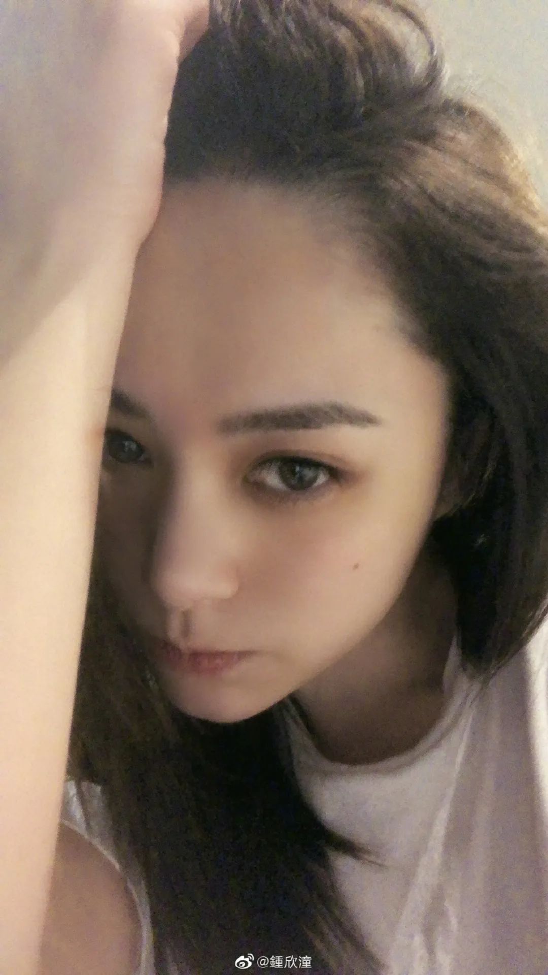 阿娇跌倒受伤,阿娇撞到额头