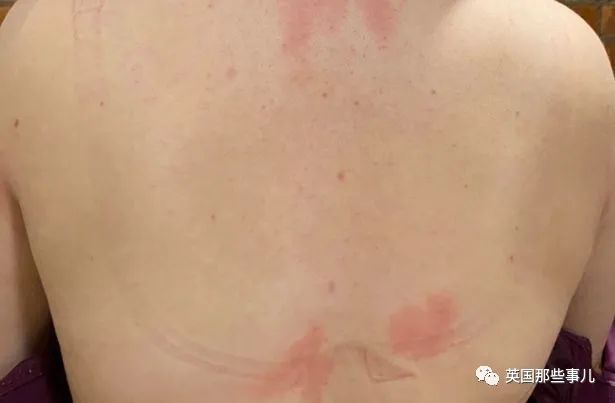 有一对J*杯罩**“卡通胸”是什么feel?妹子表示:太痛苦!很辛苦