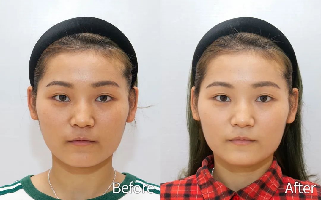 粉丝分享｜踏踏实实打好“肌”础真的有用