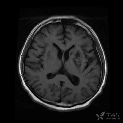 24岁小伙喝下安眠药后续,小伙吃安眠药睡觉