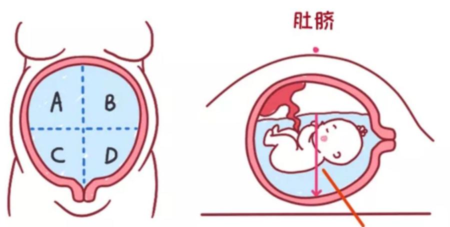 关于羊水的正确描述是什么,关于羊水的问题有哪些