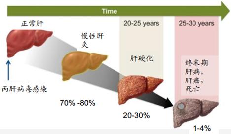 丙肝诺奖是什么,丙肝病毒的知识