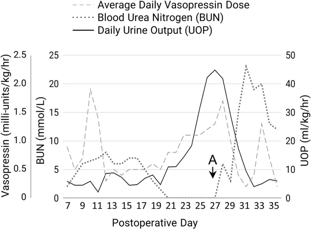 继发性中枢性尿崩症的意思,继发性中枢性尿崩症最常见病因