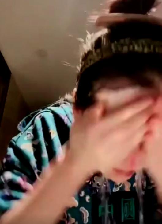 赵本山女儿承认整容了吗,赵本山女儿整容被质疑