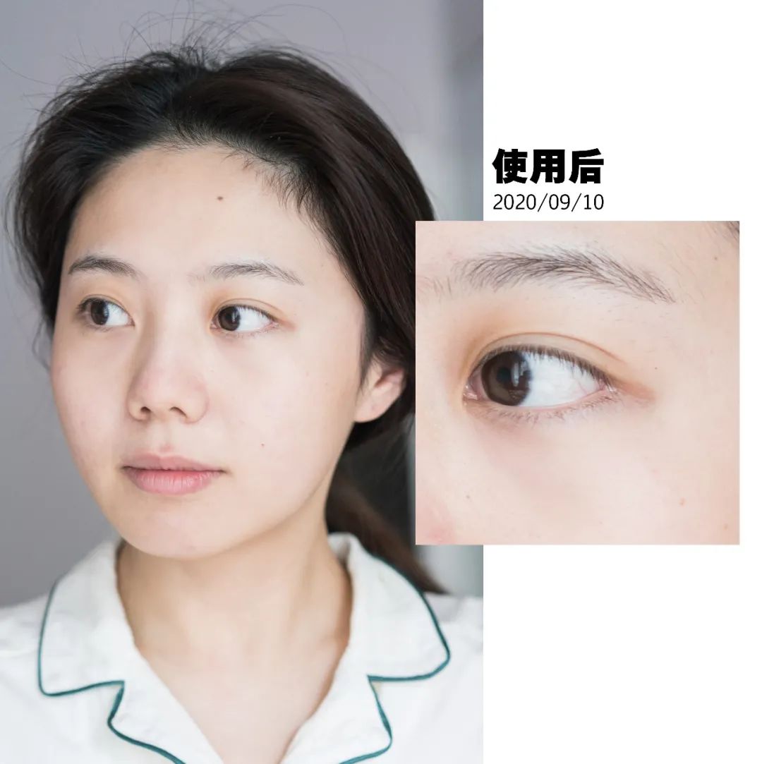 真实有用的几款美容仪,坚持用5年的美容仪