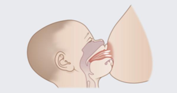 孩子经常刷牙为什么还会蛀牙,天天刷牙怎么还蛀牙