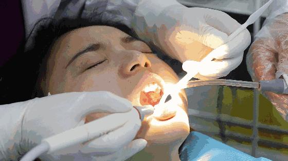 烟黄牙齿用什么牙膏牙齿能变白,黄牙烟渍牙有救了