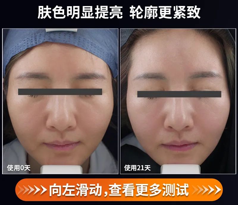 射频美容仪到底怎样,射频美容仪合格吗