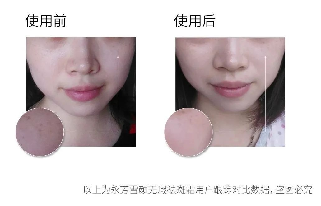 推荐一下你们用过的最好的祛斑霜,公认十大最好的祛斑霜