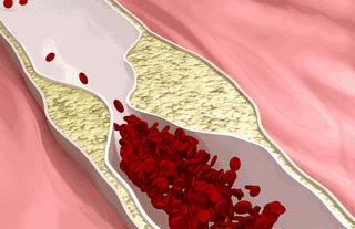 如何快速丰胸且不会反弹,不吃药怎么丰胸