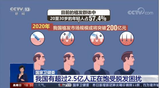无锡新生植发：每6人中有1人脱发，20到30岁人占比大