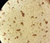 兄弟血型a型和b型有什么区别,怎么分辨血型a+和a-是什么血型